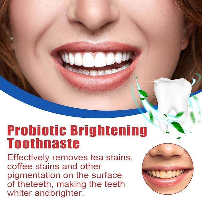 SP-4 ultra Whitening Probiotic Paste - YNT Store 
