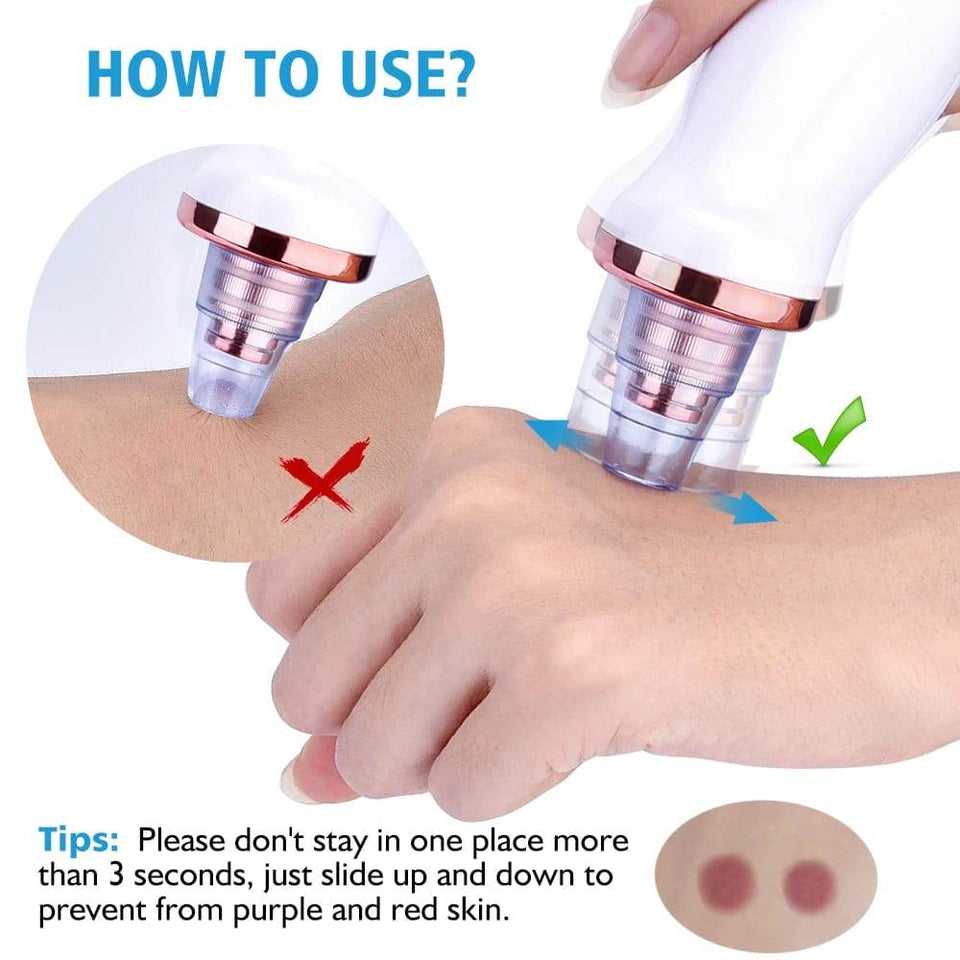 Electric Pore Cleaner & Blackhead Remover – Face Vacuum Suction Tool - YNT Store 