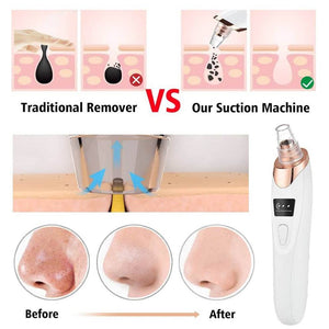 Electric Pore Cleaner & Blackhead Remover – Face Vacuum Suction Tool - YNT Store 