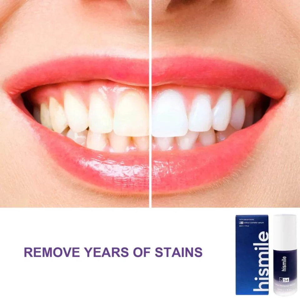 100% Original Hismile V34™ Purple Toothpaste (30 ML) 🦷 - YNT Store 